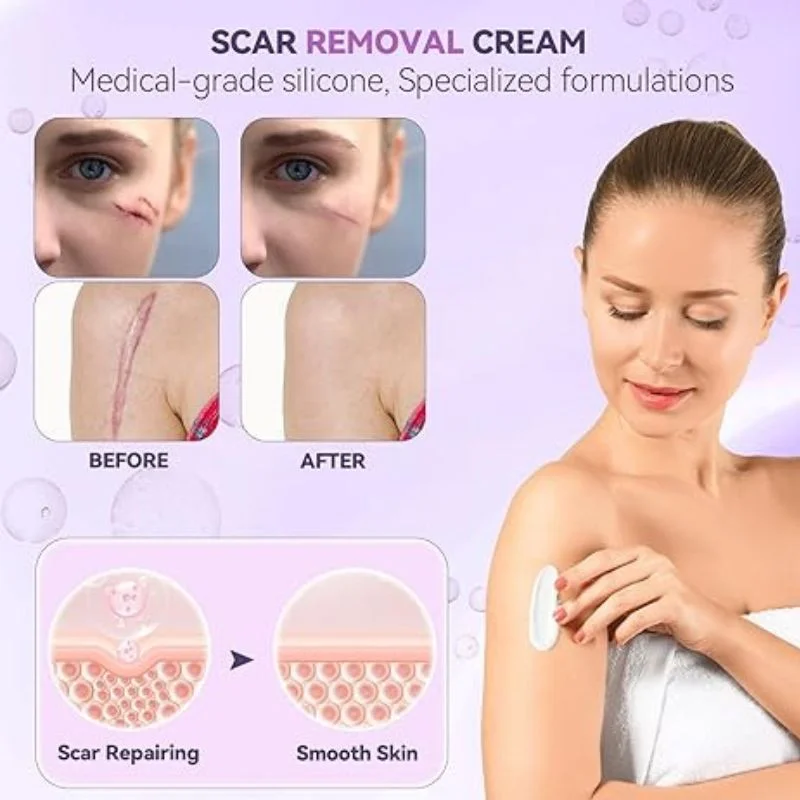 TIMILK Scarvanisher Scar Gel 30g | Advanced Scar & Stretch Marks Removal Cream | Fast-Absorbing Skin Repair Gel - Image 3