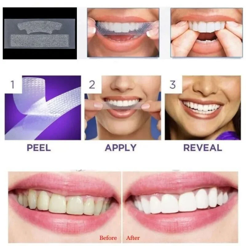 Gegemoon 9D Teeth Whitening Strips | Professional Teeth Whitening Kit | Enamel Safe Whitening Strips | Deep Stain Removal | Mint Flavor | 7 Pairs - Image 6